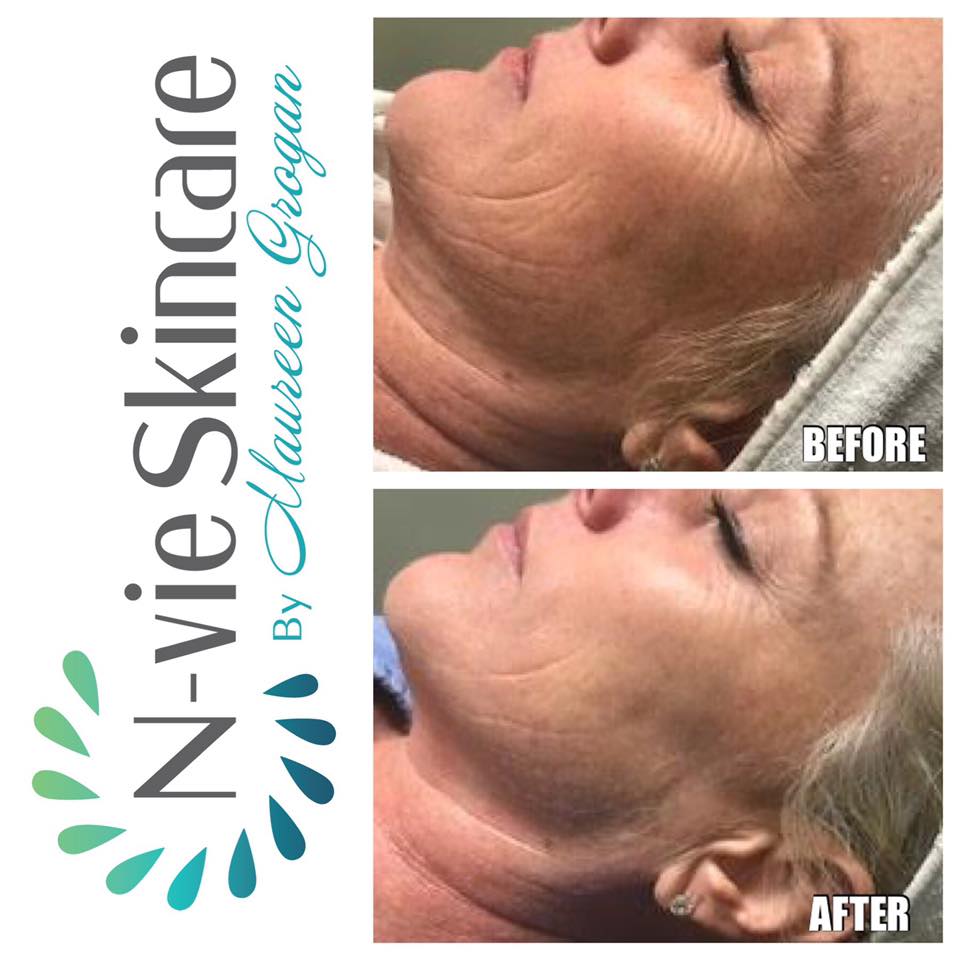 Diamond-Glow-Facial-Nvie-Skincare.jpg
