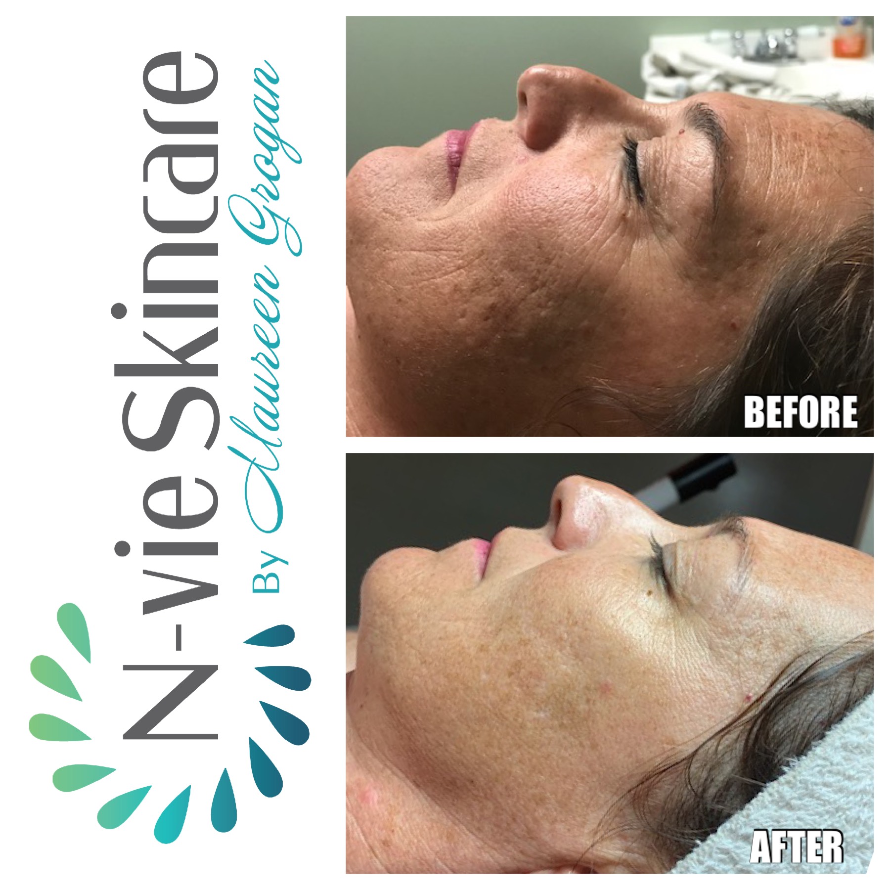 Cosmedix-Timeless-Peel-Facial-Nvie-Skincare.jpg